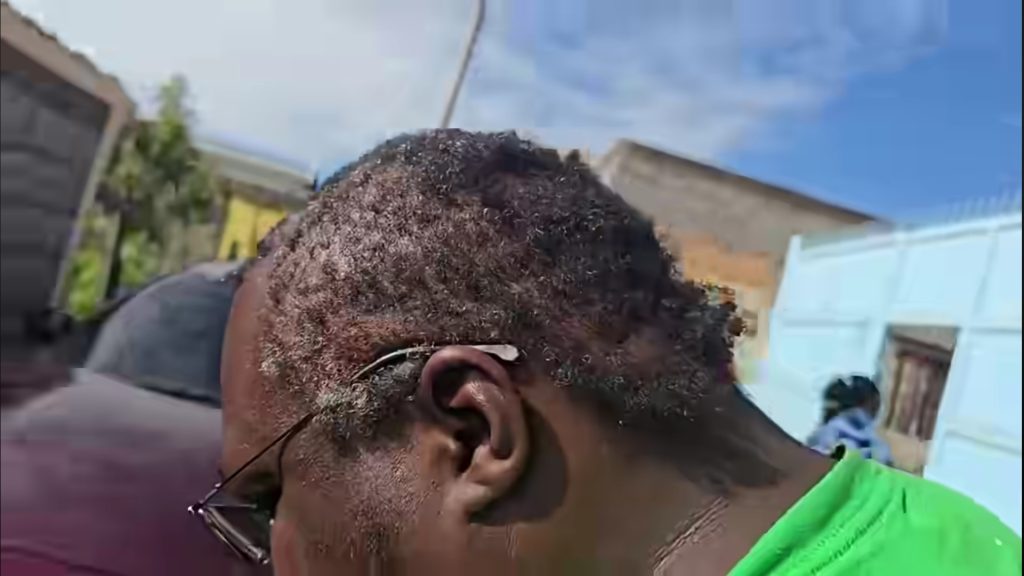 Drama as politician is abducted and shaved in Nyandarua
