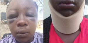 Police Pursue Cruel Landlord Who Assaulted, Violently Evicted Kakamega Lady