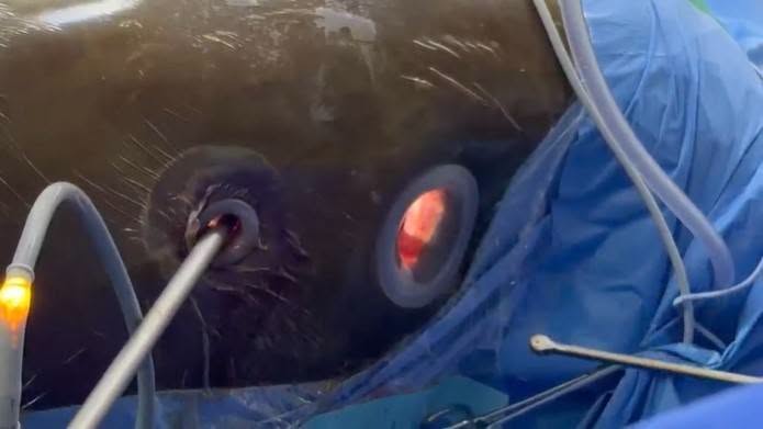 KNH Makes Medical History With Kenya’s First Minimally Invasive Esophagectomy