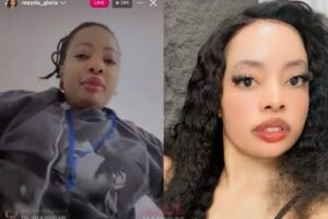 Viral Kanjo lady Gloria Ntazola has revealed that she underwent cosmetic surgery in Nigeria