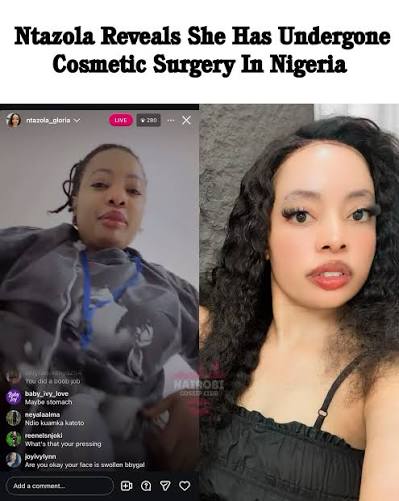 Viral Kanjo lady Gloria Ntazola has revealed that she underwent cosmetic surgery in Nigeria